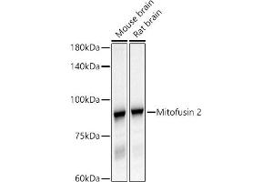 Western blot analysis of extracts of various cell lines, using Mitofusin 2 antibody (ABIN6133825, ABIN6143800, ABIN6143803 and ABIN6216518) at 1:500 dilution. (MFN2 抗体  (AA 500-600))