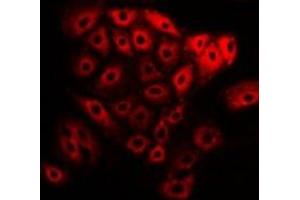 Immunofluorescent analysis of NEK2 staining in U2OS cells.