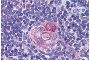 Human Thymus: Formalin-Fixed, Paraffin-Embedded (FFPE) (PYCARD 抗体  (AA 31-46))