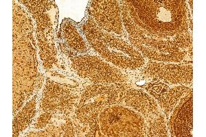 ABIN6262905, ABIN6268707, ABIN6268708 and ABIN6268709 at 1/100 staining Rat ovary tissue by IHC-P. (Lamin B1 抗体)