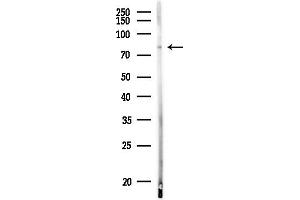 Western blot analysis of lysates from MDA-MB-231 cells(heat-shock,45 min treatment), using MCM7 Antibody at 1/1000 dilution.