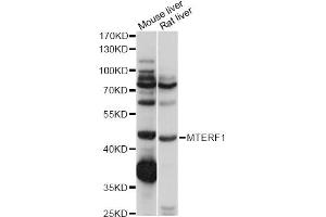 Western blot analysis of extracts of various cell lines, using MTERF1 antibody (ABIN6291170) at 1:1000 dilution. (MTERF 抗体)