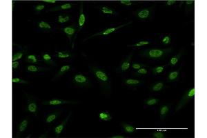 Immunofluorescence of monoclonal antibody to LMO4 on HeLa cell. (LMO4 抗体  (AA 1-165))