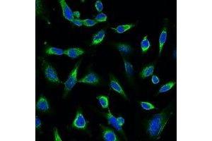Immunofluorescent analysis of Peroxiredoxin 1 staining in Hela cells. (Peroxiredoxin 1 抗体)