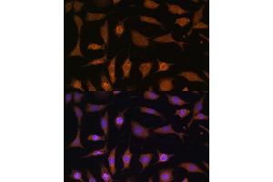 Immunofluorescence analysis of L929 cells using PDE6D Polyclonal Antibody (ABIN7269303) at dilution of 1:100 (40x lens). (PDE6D 抗体  (AA 1-150))