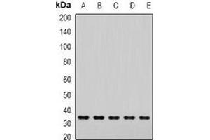 Western blot analysis of SNAP-alpha expression in Hela (A), Jurkat (B), mouse brain (C), mouse lung (D), rat liver (E) whole cell lysates. (NAPA 抗体)