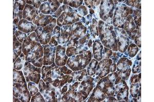 Immunohistochemical staining of paraffin-embedded colon tissue using anti-TPMT mouse monoclonal antibody. (TPMT 抗体)