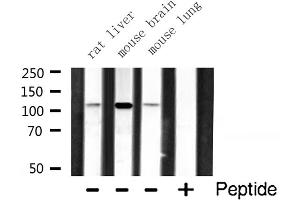 Western blot analysis of RBM26 expression in various lysates (RBM26 抗体  (Internal Region))