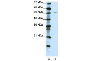 ZNF286 antibody (20R-1219) used at 5 ug/ml to detect target protein. (ZNF286A 抗体  (C-Term))