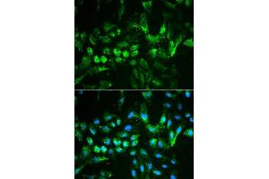 Immunofluorescence analysis of MCF7 cell using TIMP2 antibody. (TIMP2 抗体  (AA 100-200))