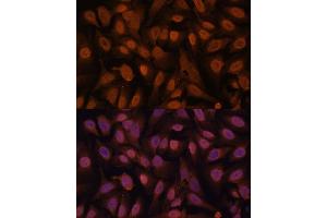 Immunofluorescence analysis of U-2 OS cells using ZNF131 antibody (ABIN7271453) at dilution of 1:100. (ZNF131 抗体  (AA 80-240))