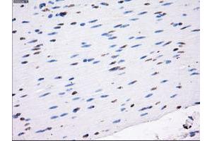 Image no. 5 for anti-Lysyl Oxidase (LOX) (AA 22-168) antibody (ABIN1491218) (LOX 抗体  (AA 22-168))