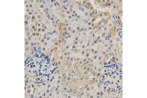 Immunohistochemistry of paraffin-embedded mouse kidney using RBFOX3 antibody at dilution of 1:200 (x400 lens). (NeuN 抗体)