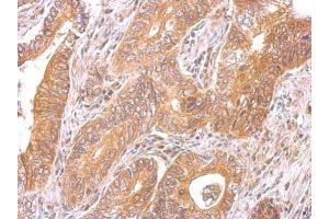 Immunohistochemistry (IHC) image for anti-Coiled-Coil Domain Containing 170 (CCDC170) (C-Term) antibody (ABIN2856492)