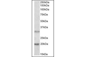 Image no. 1 for anti-Asparaginase Like 1 (ASRGL1) (Internal Region) antibody (ABIN374933) (ASRGL1 抗体  (Internal Region))