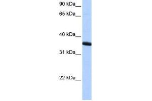 Western Blot showing ZNF389 antibody used at a concentration of 1-2 ug/ml to detect its target protein. (ZNF192P1 抗体  (N-Term))