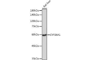 Western blot analysis of extracts of Rat liver, using CYP26 Rabbit mAb (ABIN7266654) at 1:1000 dilution. (CYP26A1 抗体)