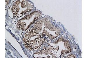 Immunohistochemistry (IHC) image for anti-Minichromosome Maintenance Complex Component 2 (MCM2) (AA 601-700) antibody (ABIN676238) (MCM2 抗体  (AA 601-700))