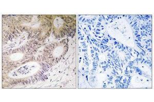 Immunohistochemistry (IHC) image for anti-Ribosomal Protein S6 Kinase, 90kDa, Polypeptide 5 (RPS6KA5) (Ser212) antibody (ABIN1848238) (MSK1 抗体  (Ser212))