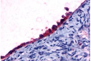 Anti-GPR108 antibody  ABIN1048687 IHC staining of human ovary, surface epithelium. (GPR108 抗体  (Cytoplasmic Domain))