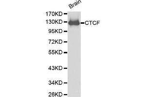 Western Blotting (WB) image for anti-CCCTC-Binding Factor (Zinc Finger Protein) (CTCF) (AA 1-260) antibody (ABIN6215164) (CTCF 抗体  (AA 1-260))
