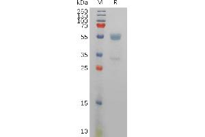 SDS-PAGE (SDS) image for Killer Cell Lectin-Like Receptor Subfamily D, Member 1 (KLRD1) protein (Fc Tag) (ABIN7491205)