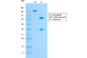 SDS-PAGE Analysis Purified Glycophorin A Rabbit Monoclonal Antibody (GYPA/1725R). (Recombinant CD235a/GYPA 抗体)