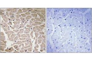 Immunohistochemistry (IHC) image for anti-Collagen, Type XVI, alpha 1 (COL16A1) (AA 1121-1170) antibody (ABIN1534357)