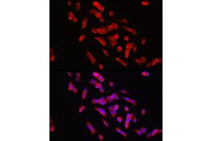 Immunofluorescence analysis of SH-SY5Y cells using PTPN5 Rabbit pAb (ABIN7269705) at dilution of 1:150 (40x lens). (PTPN5 抗体  (AA 360-490))