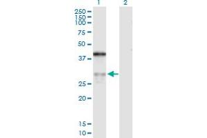 Western Blot analysis of ASPH expression in transfected 293T cell line by ASPH MaxPab polyclonal antibody. (Aspartate beta Hydroxylase 抗体  (AA 1-270))