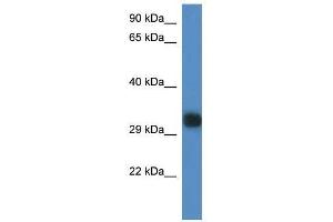 Western Blot showing Gm527 antibody used at a concentration of 1. (GM527 抗体  (C-Term))