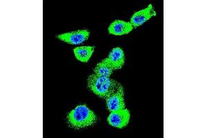 Confocal immunofluorescent analysis of CAV2 Antibody (N-term) (ABIN652586 and ABIN2842393) with MDA-M cell followed by Alexa Fluor 488-conjugated goat anti-rabbit lgG (green). (Caveolin 2 抗体  (N-Term))