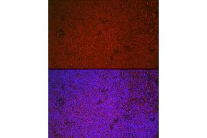 Immunofluorescence analysis of mouse spleen cells using ETS1 Rabbit pAb (ABIN7271258) at dilution of 1:100 (40x lens). (ETS1 抗体  (AA 1-260))