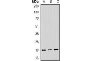 Western blot analysis of NAT13 expression in SKOV3 (A), MCF7 (B), mouse brain (C) whole cell lysates.