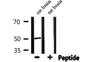 Western Blotting (WB) image for anti-Proteasome (Prosome, Macropain) 26S Subunit, Non-ATPase, 12 (PSMD12) (Internal Region) antibody (ABIN6257738)