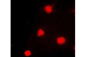 Immunofluorescent analysis of NAT5 staining in A549 cells. (NAT5 抗体)