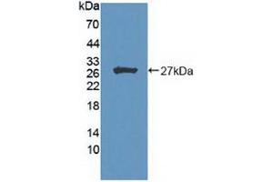 Western blot analysis of recombinant Human HIPK2. (HIPK2 抗体  (AA 977-1198))