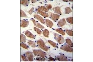 SD7 Antibody (Center) (ABIN655358 and ABIN2844917) immunohistochemistry analysis in formalin fixed and paraffin embedded human skeletal muscle followed by peroxidase conjugation of the secondary antibody and DAB staining. (SAMD7 抗体  (AA 202-230))