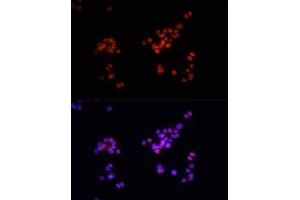 Immunofluorescence analysis of PC-12 cells using Phospho-Smad2-S465/467 + Smad3-S423/425 antibody (ABIN6135314, ABIN6136248, ABIN6136249 and ABIN6225575) at dilution of 1:100. (SMAD2 / SMAD3 (pSer423), (pSer425) 抗体)