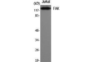 Western Blot (WB) analysis of specific cells using FAK Polyclonal Antibody. (FAK 抗体  (Thr446))