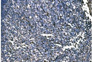 IHC analysis of PKM2 using anti-PKM2 antibody (ABIN3043381).