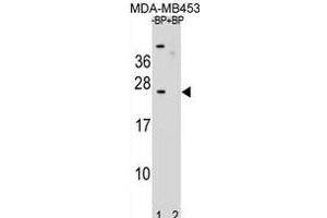 Western blot analysis of SSX6 Antibody (Center) Pab (ABIN1881838 and ABIN2839021) pre-incubated without(lane 1) and with(lane 2) blocking peptide in MDA-M cell line lysate. (SSX6 抗体  (AA 62-91))