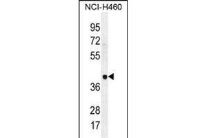LRRC38 Antibody (C-term) (ABIN655842 and ABIN2845255) western blot analysis in NCI- cell line lysates (35 μg/lane). (LRRC38 抗体  (C-Term))