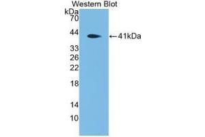 Detection of Recombinant DEFa4, Mouse using Polyclonal Antibody to Defensin Alpha 4, Corticostatin (DEFa4) (DEFA4 抗体  (AA 20-92))