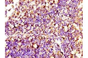 Immunohistochemistry of paraffin-embedded human tonsil tissue using ABIN7169699 at dilution of 1:100 (SIPA1 抗体  (AA 759-927))