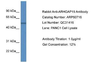 Western Blotting (WB) image for anti-rho GTPase Activating Protein 19 (ARHGAP19) (C-Term) antibody (ABIN2788551) (ARHGAP19 抗体  (C-Term))