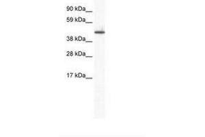 Image no. 1 for anti-Zinc Finger Protein 557 (ZNF557) (AA 298-347) antibody (ABIN6736004) (ZNF557 抗体  (AA 298-347))