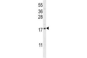 CXCL12 antibody western blot analysis in NCI-H292 lysate. (CXCL12 抗体  (AA 64-92))