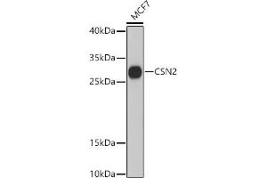 Western blot analysis of extracts of MCF7 cells, using CSN2 antibody (ABIN6133604, ABIN6139112, ABIN6139113 and ABIN6216490) at 1:3000 dilution. (CSN2 抗体  (AA 1-100))