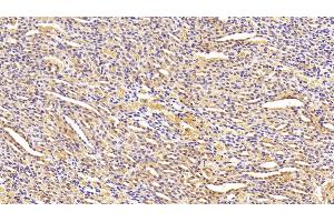 Immunohistochemistry (IHC) image for anti-Angiopoietin-Like 4 (ANGPTL4) (AA 182-388) antibody (ABIN7433018)